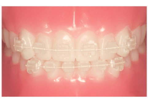 teeth_image